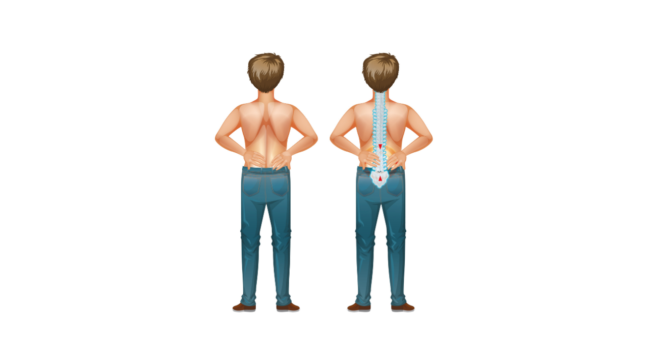 Ejercicios de yoga para la escoliosis